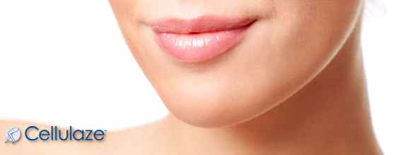 Laser Facelift