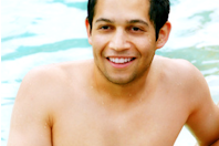 Laser Sweat Reduction